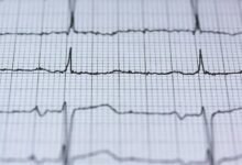 photon pulse engine model